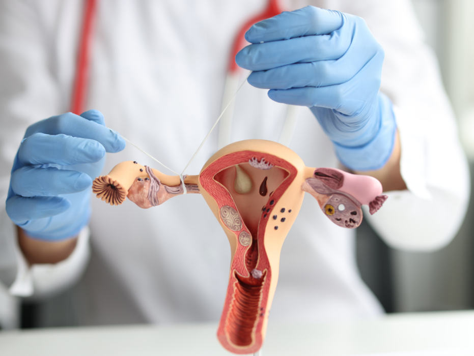 Todo lo que necesitas saber sobre la Salpingoclasia